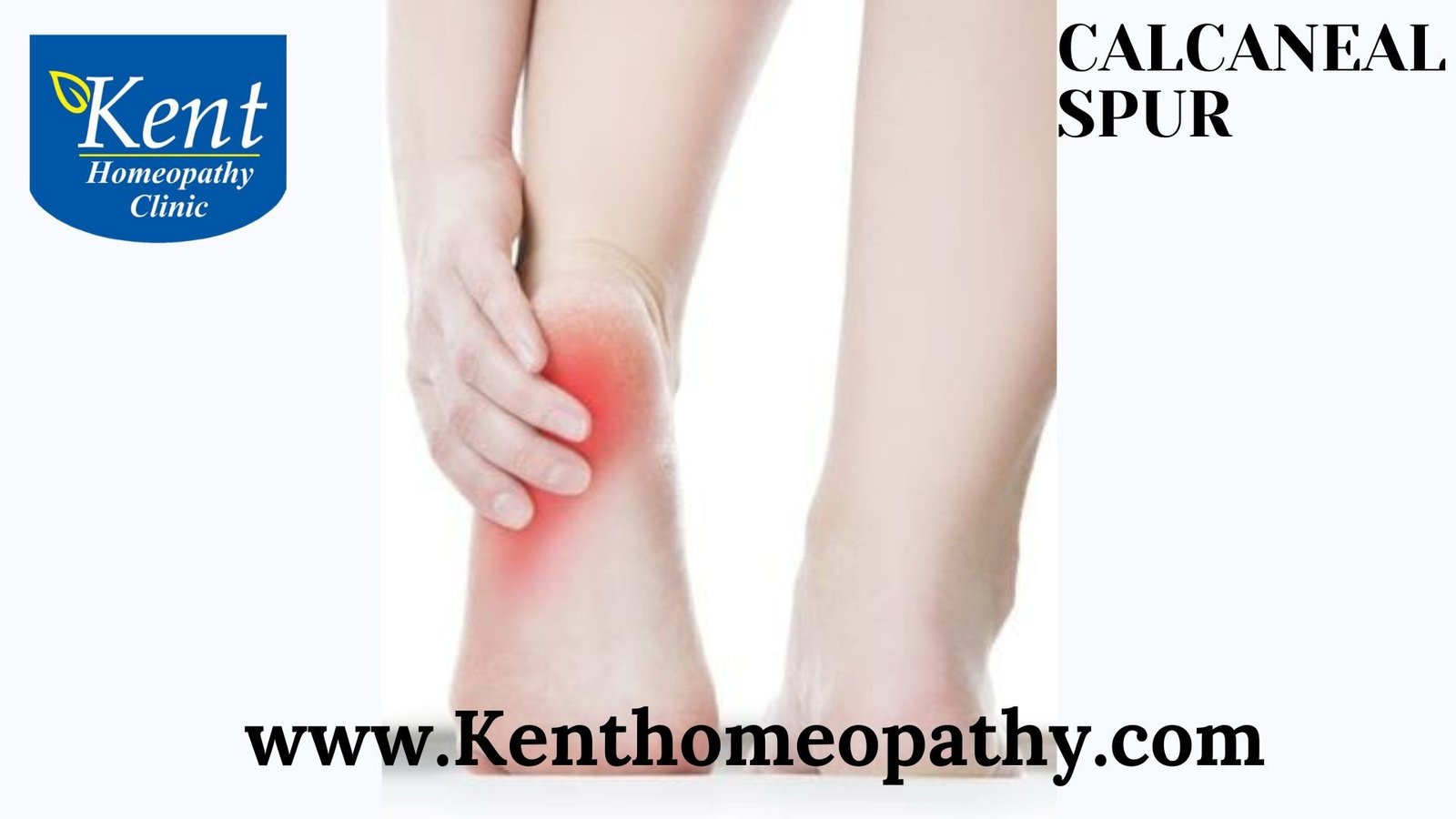 Calcaneal Spur (Heel Spur) | Kenthomoepathy | Powai | Mumbai ...